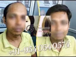 As for hair weight, normally one bundle of quality hair extensions is 100gram, more weight will be more expensive. Hair Weaving For Men In Delhi 9540540574 Cost Of Hair Weaving Youtube