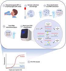 What i was told by doctors in italy, that those who died from covid were often the people who received the previous. Current And Innovative Methods For The Diagnosis Of Covid 19 Infection Review