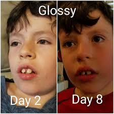 autism lip gloss business