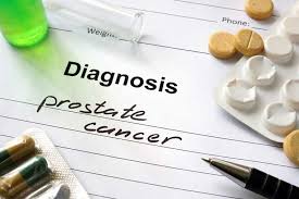No one knows why or how prostate cancer starts. Prostate Cancer Diagnostics Treatment Apollomedics
