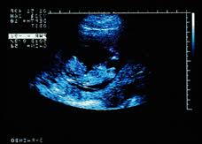 Just had an ultrasound this morning at 10 weeks 2 days! You Are 10 Weeks And 3 Days Pregnant Familyeducation