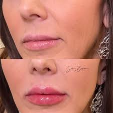 GLOW Med Spa of 30A added a new...