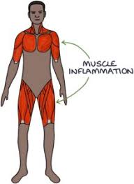 Image result for Polymyositis