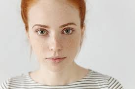 Image result for Freckled skin