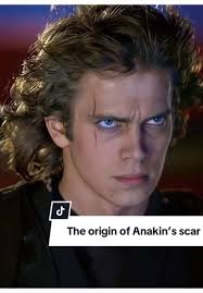 Les origines de la cicatrice d'Anakin Skywalker