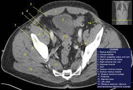 The muscular system is responsible for the movement of the human body. Pelvis Ct Anatomy Anatomy Drawing Diagram