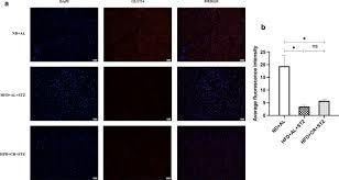 First, you have to calculate the carbohydrate coverage. Protective Effects Of Calorie Restriction On Insulin Resistance And Islet Function In Stz Induced Type 2 Diabetes Rats Nutrition Metabolism Full Text