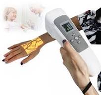 Detector De Localizador De Venas De Mano Profesional, Visor De Venas  MéDicas, Instrumento De ImáGenes De Vasos, Brillo Ajustable, 13 Colores ...