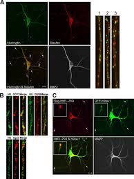 Unvaccinated americans of reddit, have you been sick a single time since the vaccine started in this country, lets just say since january 2021? A Role For Huntington Disease Protein In Dendritic Rna Granules Journal Of Biological Chemistry