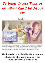 Modifications To Your Life And Surroundings May Make It Much Easier To Live With Tinnitus The Ringing Hissing Or Hum Tinnitus Cure The Cure Ear Wax Buildup