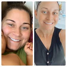 Postpartum weight loss journey and confidence building