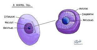 The heterochromatin is known to be in a highly condensed and transcriptionally inactive form. Nucleoli Pathology Dictionary Mypathologyreport Ca