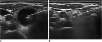 Check spelling or type a new query. Korean Journal Of Radiology