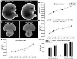 Down Syndrome Regenerative Medicine Taming The Over Expressive Trisomy Chromosome 21 Genes Maplespub