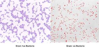 Gram stain of listeria monocytogenes (source). Gram Staining Principle Procedure Interpretation Examples And Animation