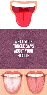 What Your Tongue Says About Your Health In 2020 Women Health Care Health And Wellness Coach Health