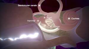 Image result for Inner Ear Decompression Sickness