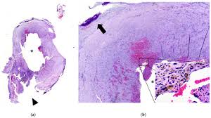 Image result for Pseudoeriosema