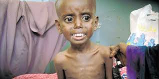 Famine is a wake-up call that we cannot ignore