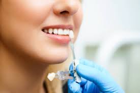 Check spelling or type a new query. Are Dental Implants Covered By Dental Insurance Smile Haus