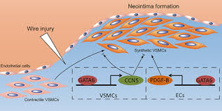 Why are mesothelium and endothelium considered separately from other types of epithelium? Cell Specific Effects Of Gata Gata Zinc Finger Transcription Factor Family 6 In Vascular Smooth Muscle And Endothelial Cells On Vascular Injury Neointimal Formation Arteriosclerosis Thrombosis And Vascular Biology
