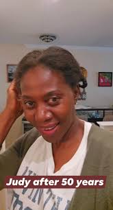 Keep your skin flawless. Avoid bleaching your skin, as it destroys your  skin and makes you look older than your age. Count down to being 55 years  old. #fypageシ #viralshorts #followers