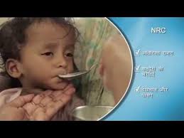 Nutrition Stabilization Centre LUMHS Jamshoro