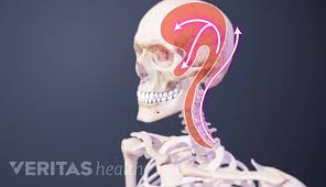 Image result for Spinal Headache