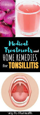 Medical Treatments And Home Remedies For Tonsillitis Tonsilitis Remedy Home Remedies Medical Treatment