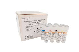 Image result for Herpes Simplex Virus Testing