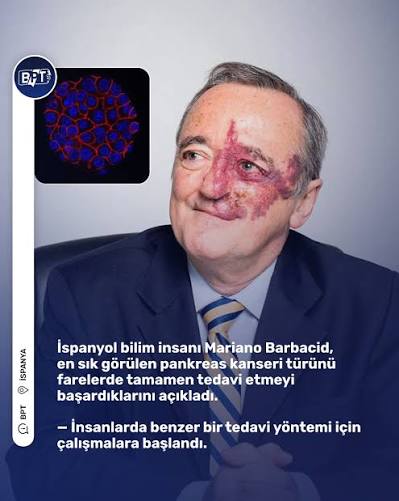 Pankreas Kanserinde Umut Veren Gelişme: Bilim İnsanlarından Üçlü Tedavi Müjdesi!