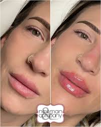 Meaghan Griffin, RN, BSN (@newbraunfelsinjector) • Instagram photos and  videos