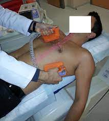 The automated external defibrillator (aed) is a device capable of automatically detecting a heart rhythm. Electrical Cardioversion Electro Shock Treatment Defibrillation D C Cardioversion Doktorekg Com Elektrokardiyografi Ekg Electrocardiography Ecg Ankara Kardiyoloji Kalp Hastaliklari Doktorekg Com