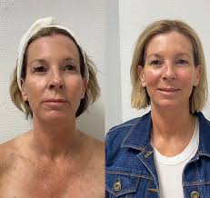 Elite Skin + Waxing (@eliteskinandwaxing) • Instagram photos and videos