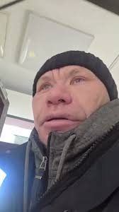 Φλεβικά laser κιρσών