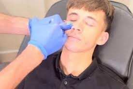 Bizarre anti-ageing trend sees men injecting salmon sperm into their faces 