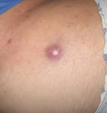 We did not find results for: Interview Mit Paul Nghiem Md Phd The Skin Cancer Foundation