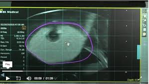 However, they do know that certain risk factors may living with prostate cancer depends on how early you were diagnosed. Adding Mri Targeted Biopsy Leads To More Reliable Diagnosis Of Aggressive Prostate Cancer Imaging Technology News