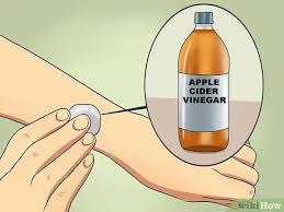 Many people suffering from ringworm applying apple cider vinegar to a ringworm infection may cause a slight stinging sensation at first. How To Treat Ringworm With Pictures Wikihow