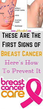 Breast cancer symptoms and signs. Breast Health