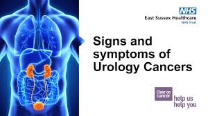 The main symptoms include if you or your child are experiencing persistent, severe or worsening bone pain, visit your gp. Signs And Symptoms Of Bowel Cancer Raj Harshen Youtube
