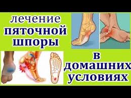 как избавиться от шпоры на стопе в домашних условиях Kak Izbavitsya Ot Pyatochnoj Shpory Raz I Navsegda Sekrety Narodnoj Mediciny Youtube