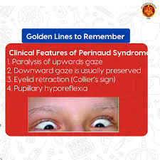 Image result for Pupillary Paralysis