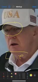 Same people who didn't give a crap about the last presidents health and it  all turned out to be true. Hopefully our president is okay!
