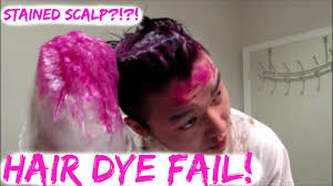 How to prevent hair dye stains? Hilarious Diy Hair Dye Fail Stained Scalp Youtube
