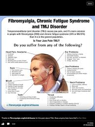 Pin On Fibromyalgia Dementia