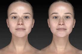 Size acceptance, body positivity, and fat activism are now part of the cultural lexicon, yet according to data f. Facial Plastic Surgery Los Angeles Sedgh Plastic Surgery