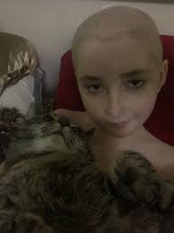 After the worst cisplatin