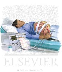 Nitroblue tetrazolium test in children with fatal granulomatous disease and newborn infants / park b.h. Nonstress Testing In Pregnancy