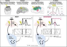 Image result for Thalamic Stimulation